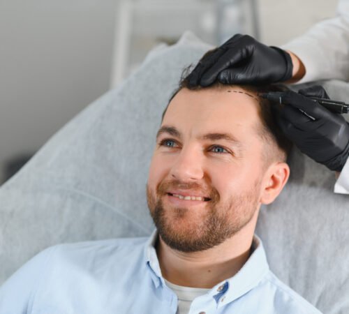 Side view of handsome man getting hair treatment at beauty salon. Man having mesotherapy session at aesthetic clinic, therapist hands in gloves making injection in scalp, closeup