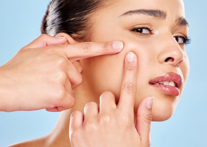 Studio portrait of an attractive young woman squeezing a zit on her face against a blue background.