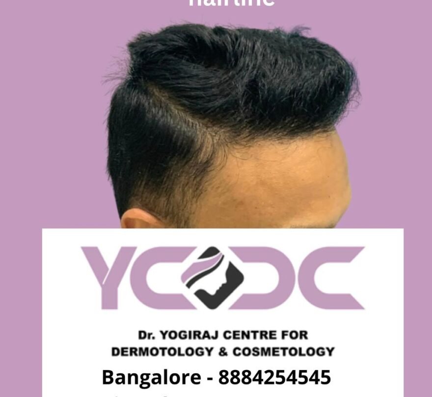 ycdc- before after2